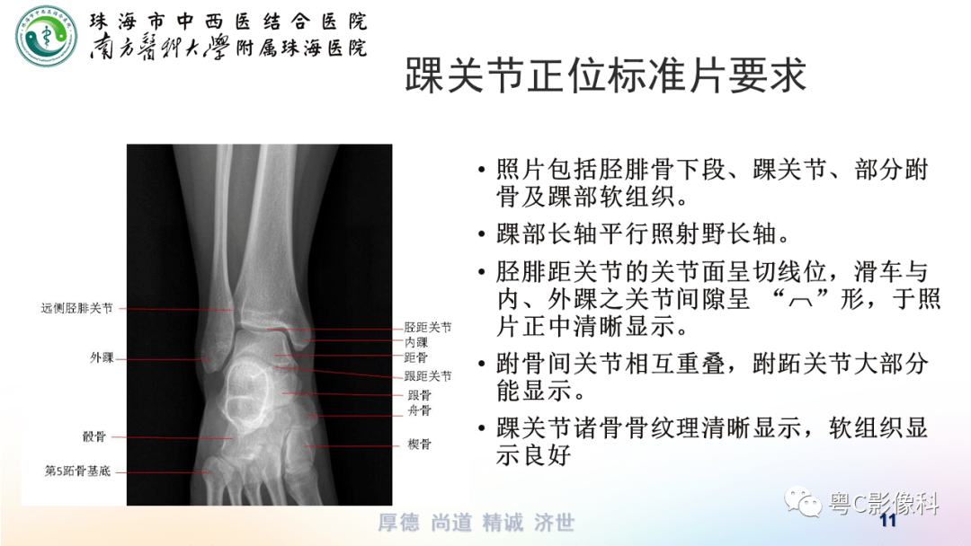 踝关节正常解剖图x线图片