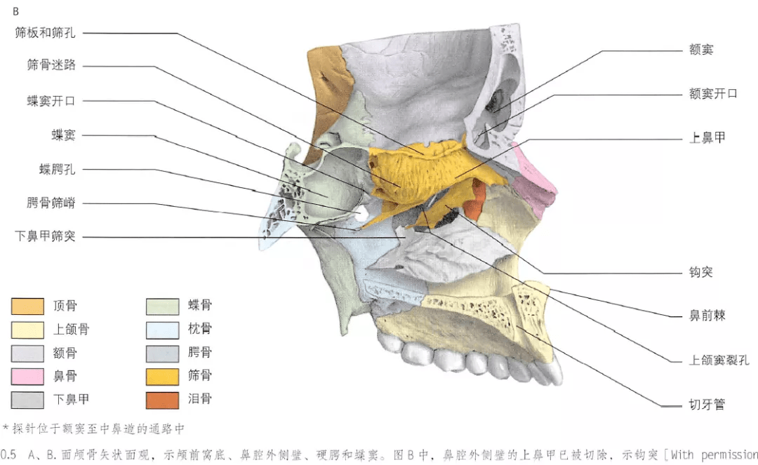 筛骨 迷路图片