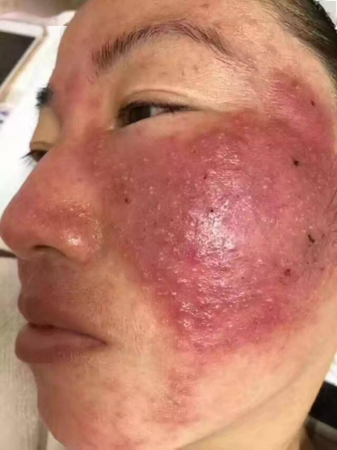 朋友圈精选:汞-就是亮,铅-就是白_皮肤_管理_问题