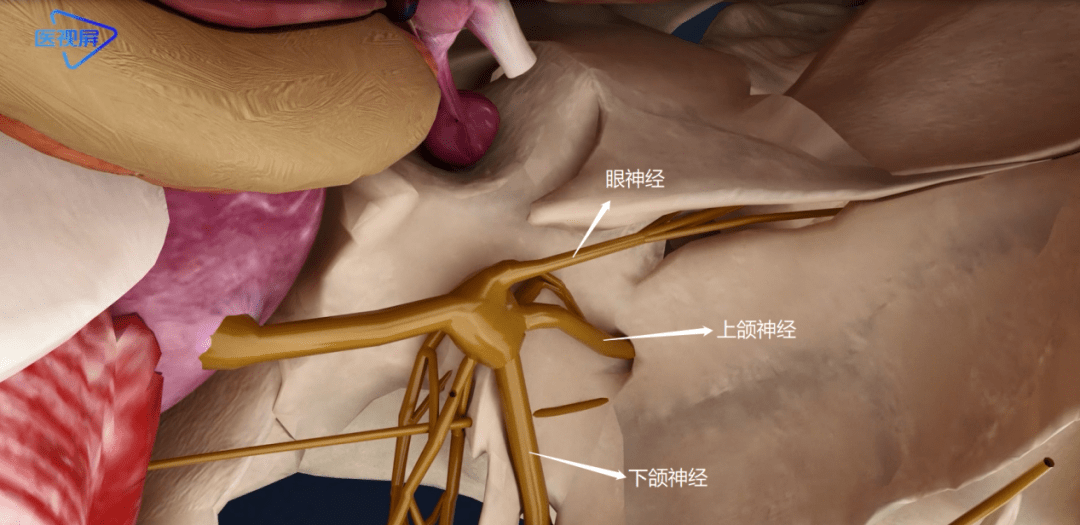 医学3d天下第一痛三叉神经的解剖结构