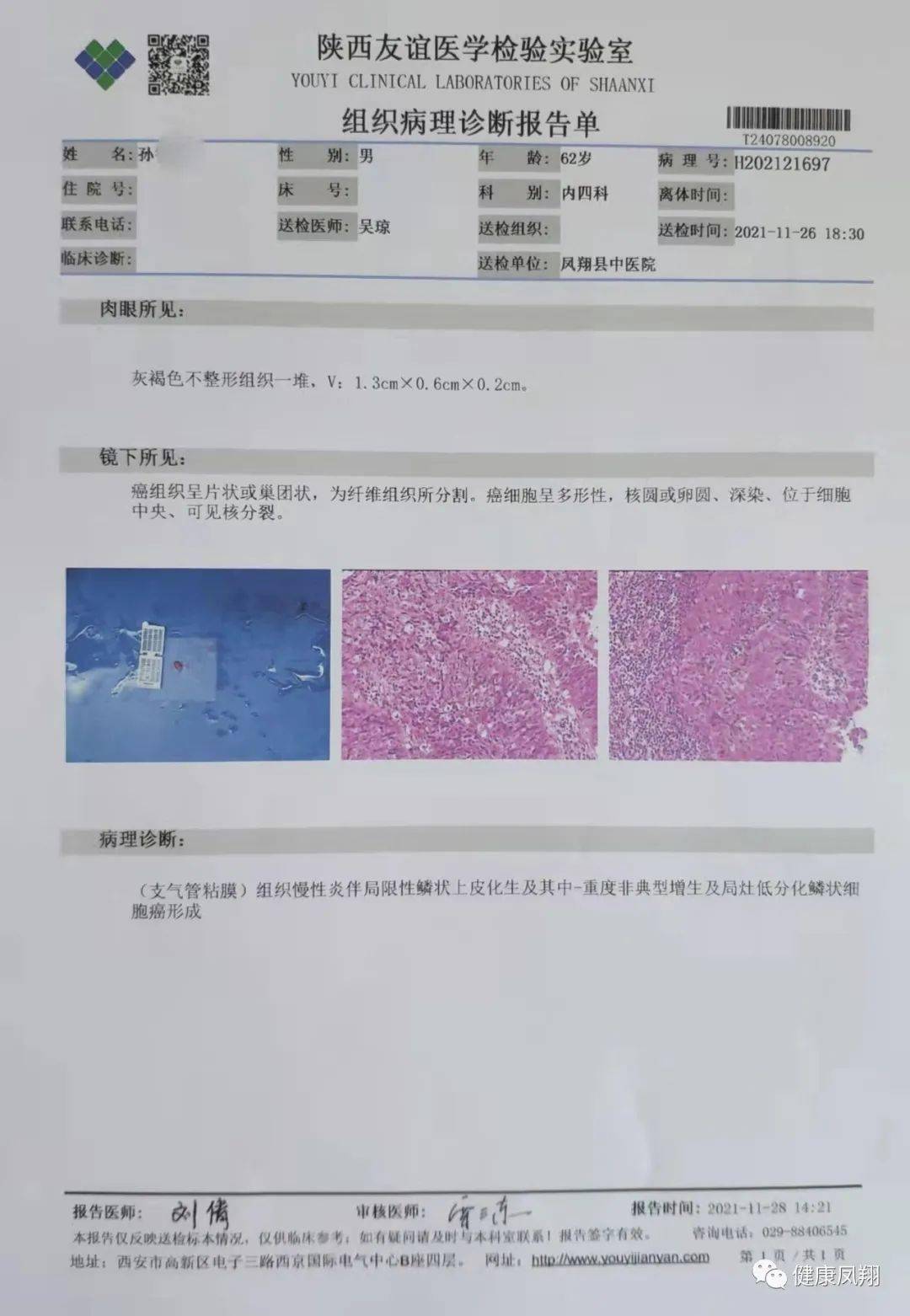 凤翔区中医院内四科特色诊疗技术之电子支气管镜_检查_气道_治疗