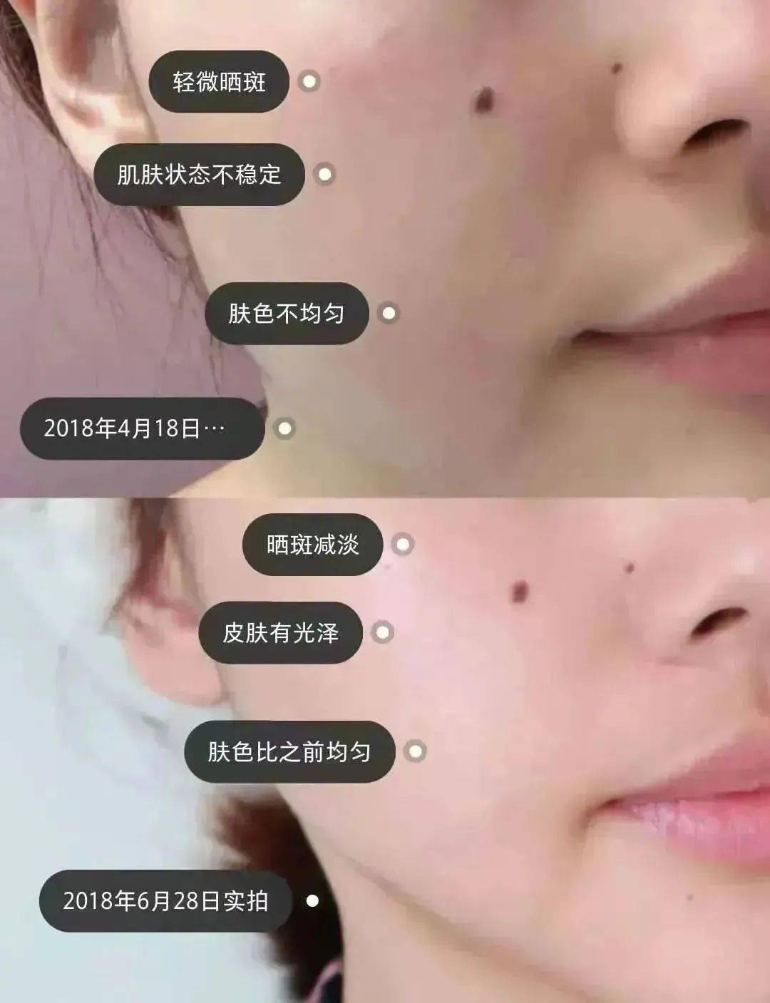 斑点K家必入爆品，让肌肤不止白，更有光！