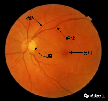 的方向移动视线,直至看到视乳头;接下来从视盘开始沿着4根主要的血管