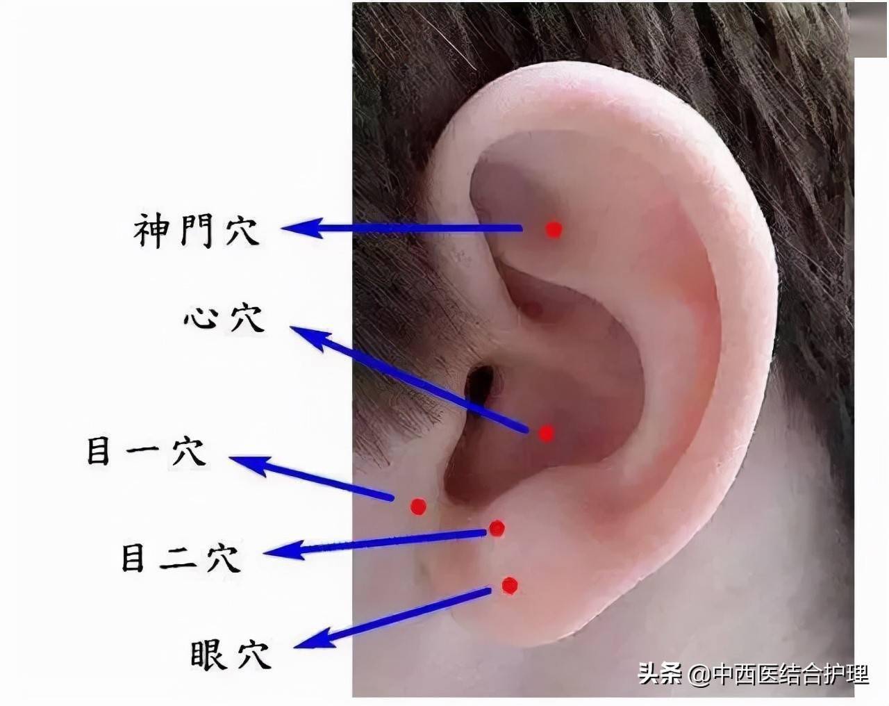 「观耳识病」耳朵上出现这些特征