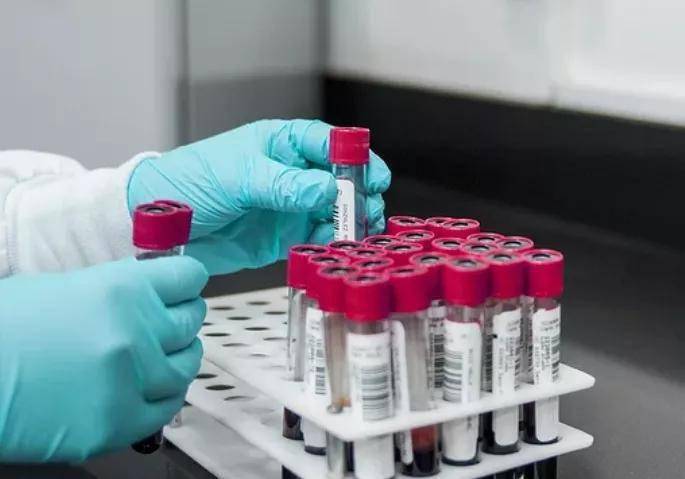 血脂|有这11种情况的人，高血脂风险很大，赶紧自查！