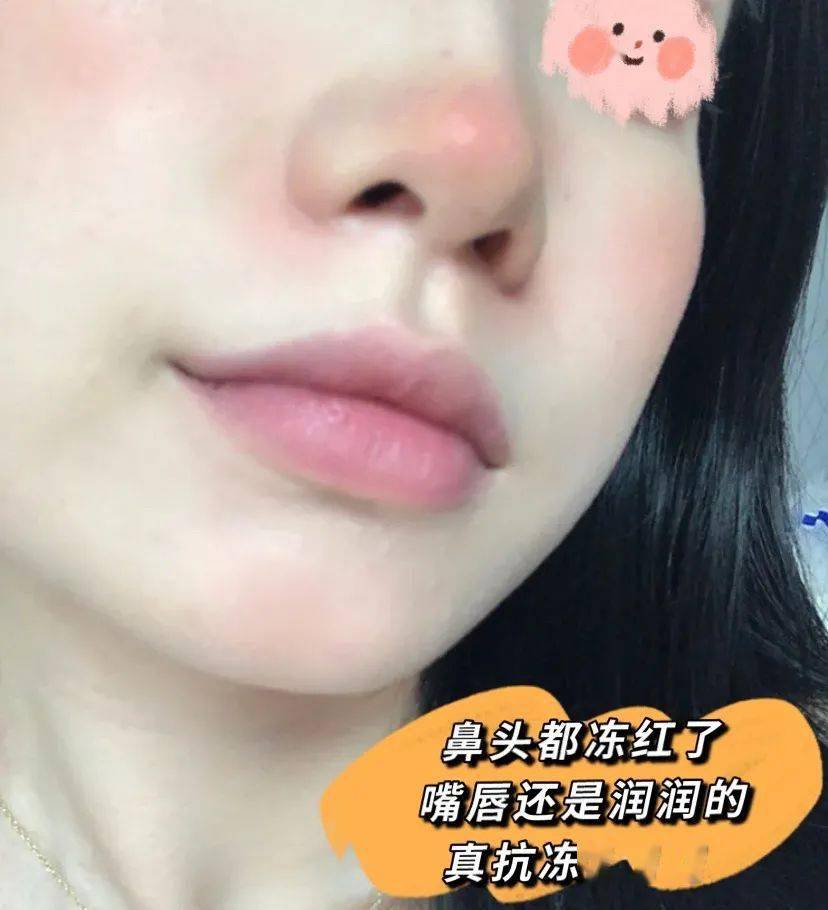 用户干唇星人的救命唇膏，涂一次等于敷n次唇膜，干皮都消失了！