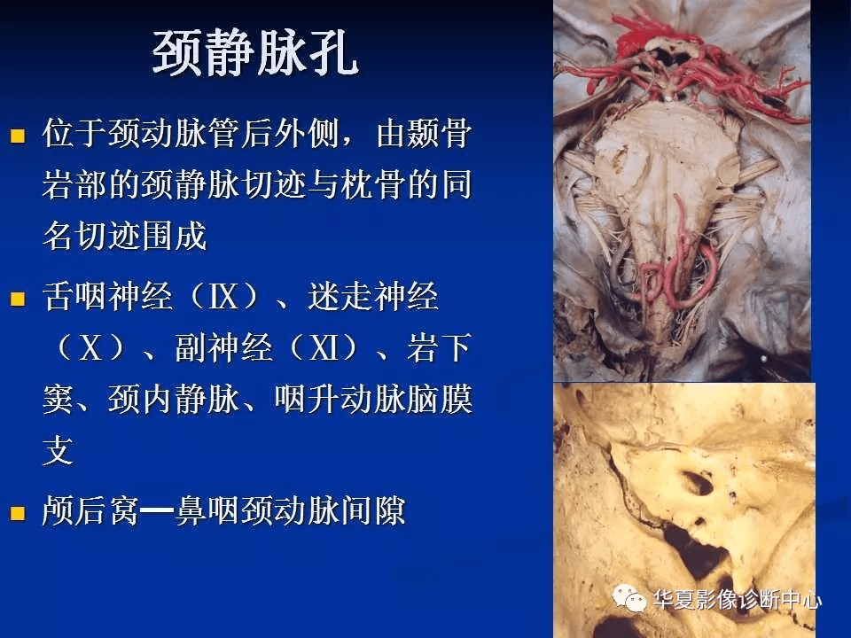 實用詳細的顱底各孔道影像解剖