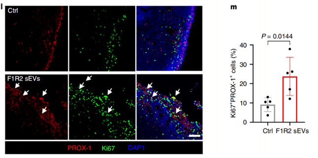 Peinado|《自然》子刊：癌细胞转移前就把“黑手”伸进了淋巴管！科学家发现，黑色素瘤细胞会释放外泌体改造淋巴管，促进肿瘤转移丨科学大发现