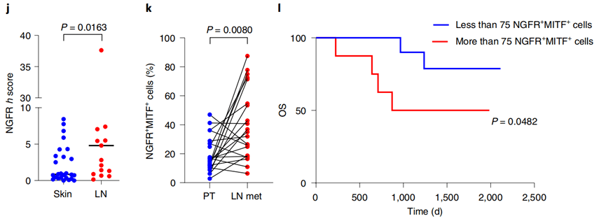 Peinado|《自然》子刊：癌细胞转移前就把“黑手”伸进了淋巴管！科学家发现，黑色素瘤细胞会释放外泌体改造淋巴管，促进肿瘤转移丨科学大发现