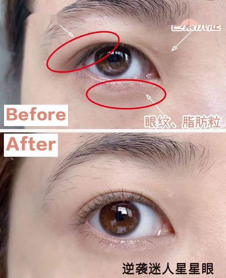 有明目之效常用于目暗不明,青盲内障氨基牛磺酸,白色结晶体人体所需的