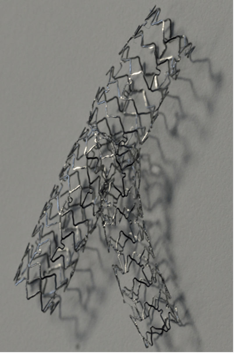 中山pci洞见25如何做好culotte术式