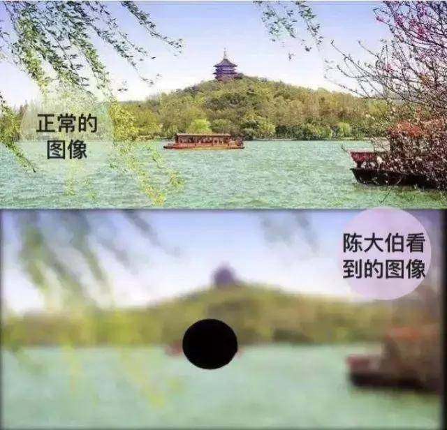 黄斑病变、高度近视？叶黄素眼黄金和花青素抗氧化之王，了解一下_视网膜_视力_眼睛