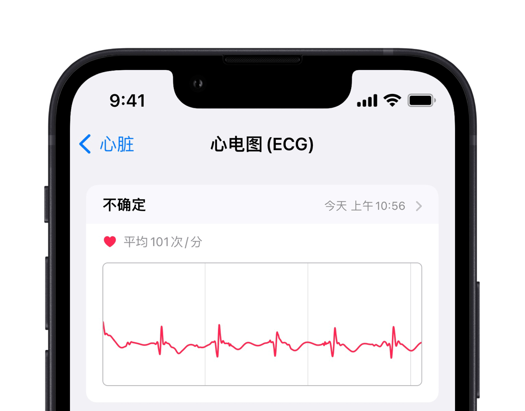 国行applewatch上线心电图功能可提醒心率不齐