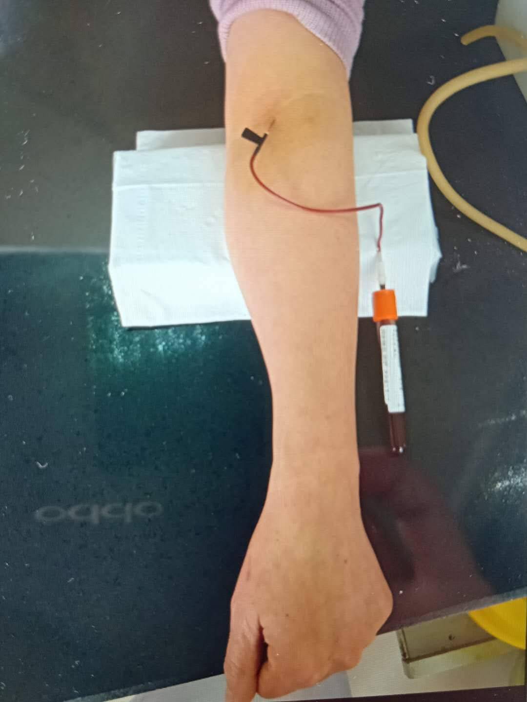 学会这四招,再难找的血管你也能一针见血!_静脉_肘部_护理