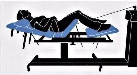 牵引是腰椎盘突出症患者治疗过程中的手段之一,具有缓解症状的作用.