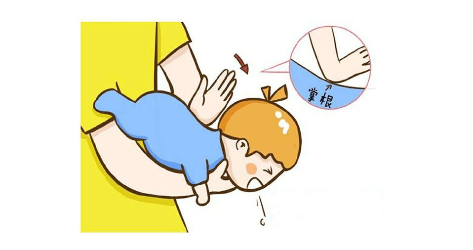 小儿异物卡喉急救办法_挤压_一手_孩子