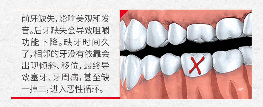 要及时找到牙齿脱落的原因,矫正口腔问题