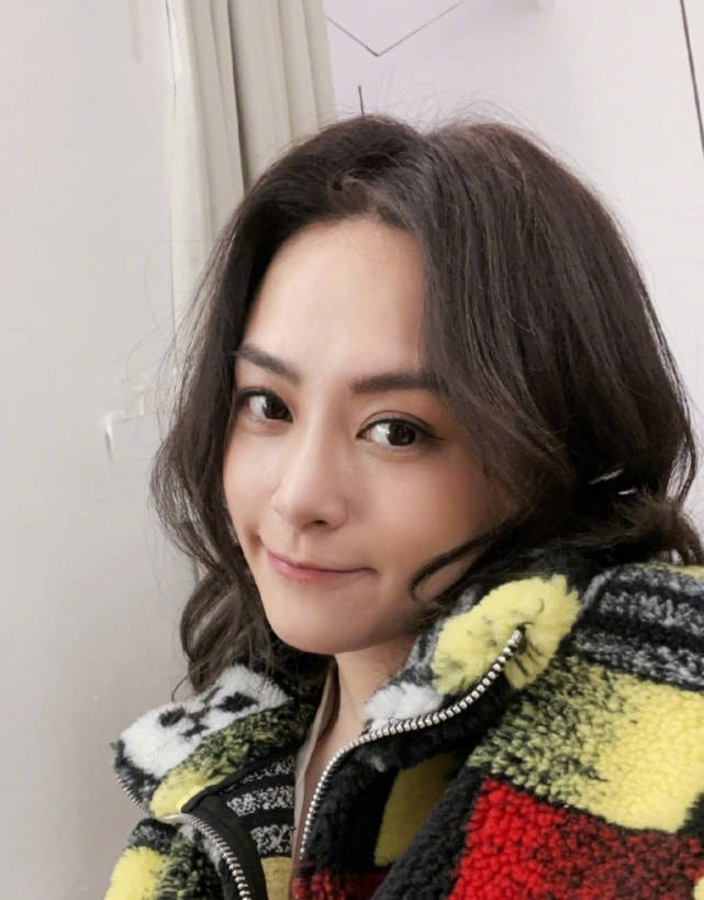 阿娇讲述撞破头经历,缝针时玩手机很淡定,郑希怡以为是特效化妆_伤口