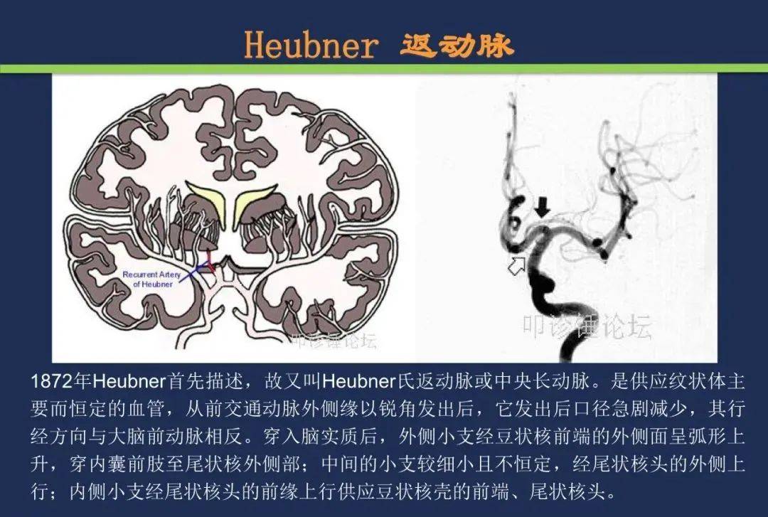 頸內動脈;大腦中動脈;大腦前動脈;heubner返動脈;紋狀體動脈;脈絡膜前