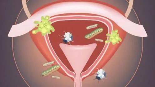 女性分泌物图片 尿道图片