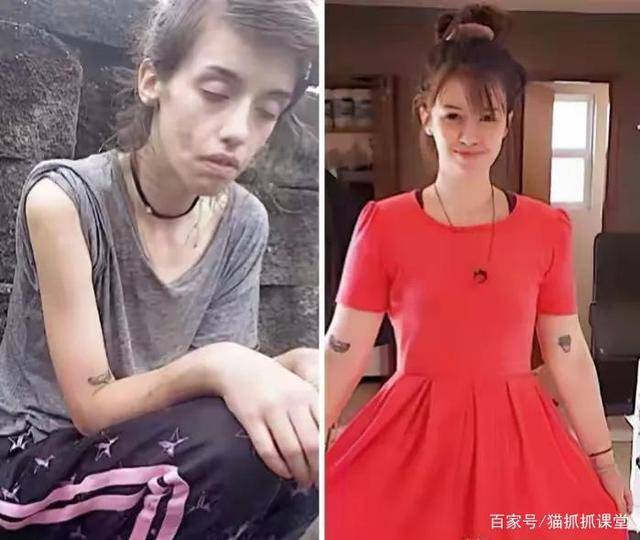 40张超治愈的对比照片,时间让我们变得越来越好,加油_变化_头发_癌症