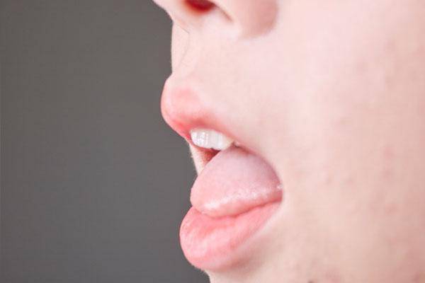 舌中裂纹怎么看