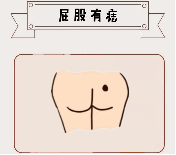 屁股有痣　　在相学中，若是一个人的屁股的方位处长有吉痣，则被称之为