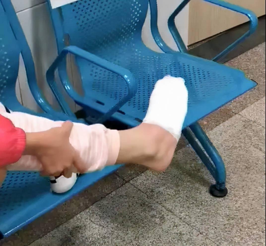 烧烫伤如何紧急自救