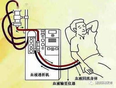 治疗|尿毒症做透析后还能活多久？根据临床数据，大多在这个范围