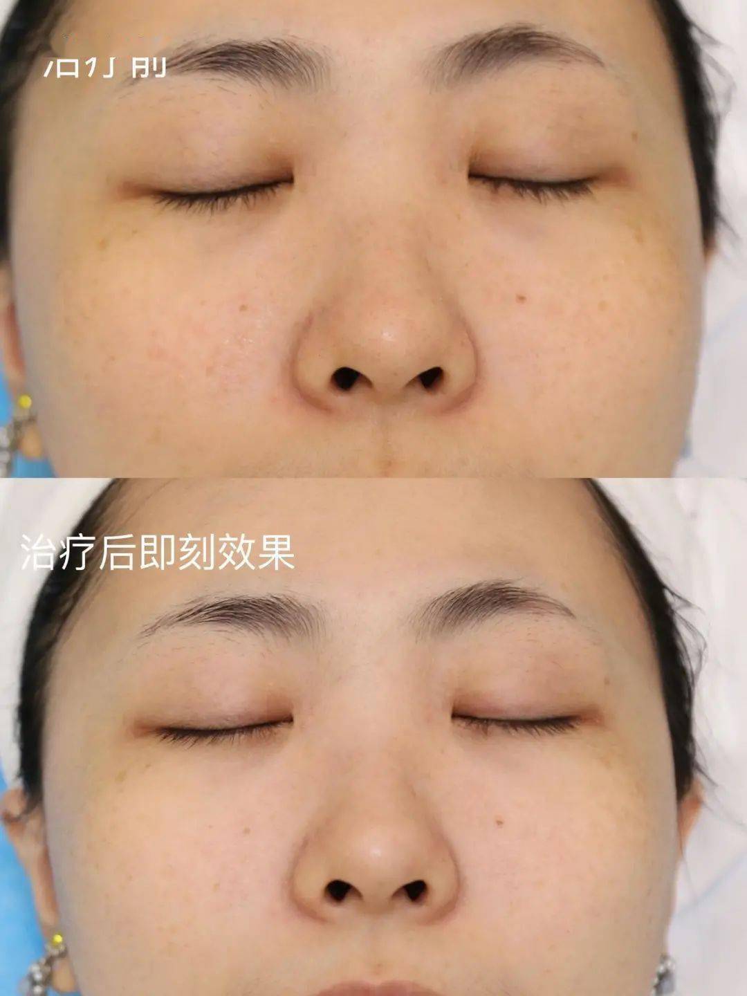 机器欧美明星罕见素颜照大盘点,最美竟是她?曝光美肤秘诀!