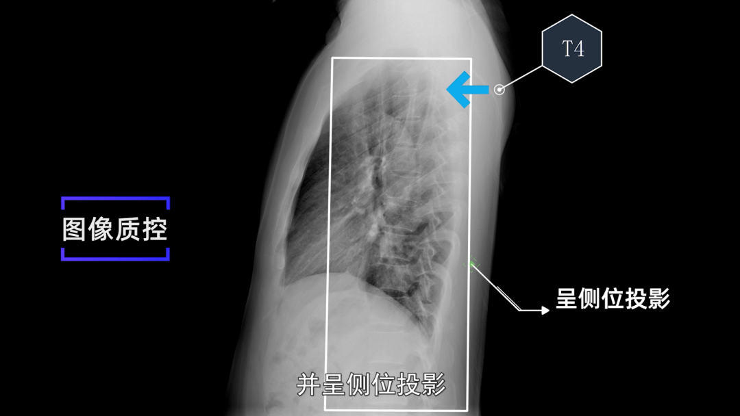 x线规范化检查 | 胸部正侧位摄影(视频及图文详解)