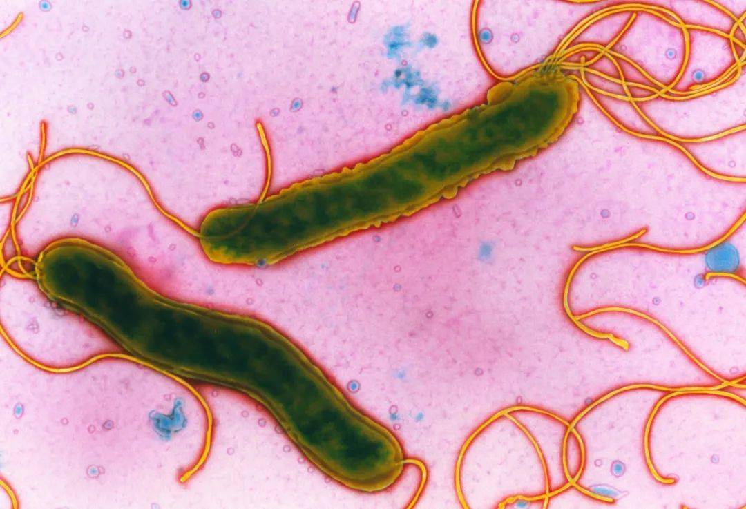美国将幽门螺旋杆菌列为明确致癌物中国平均感染率59