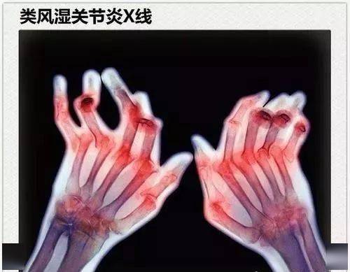 96a4c179cdf64185a9dab10e454b0cfb.jpeg