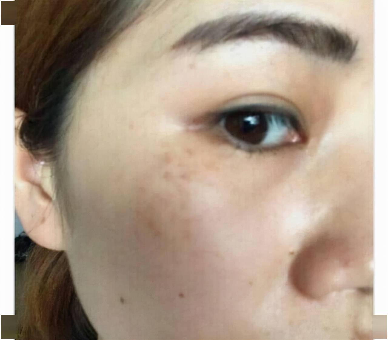 医生说出答案和用法_祛斑_皮肤_治疗