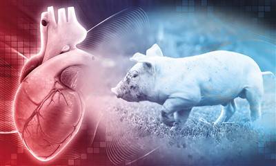 全球首例异种移植取得突破_患者_手术_心脏