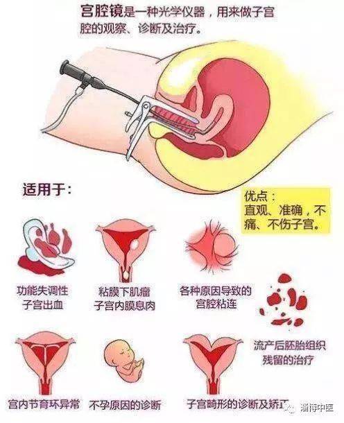 关爱子宫 关爱生命