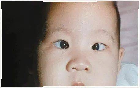 做什么运动对眼睛视力好 12676b4201c14600bbab73bb5e98c24a.jpeg