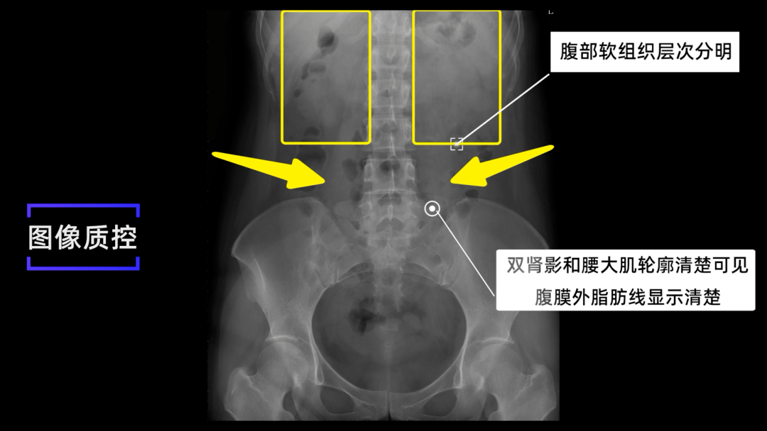 女性腹部x光图片