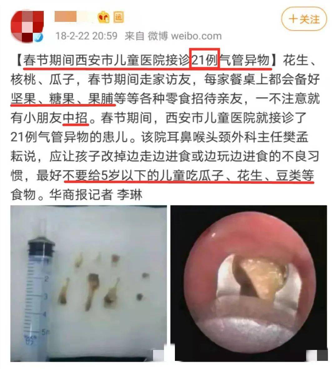 产品|超市里这 4 种“最恶心”的「儿童零食」,过年人人都爱给娃买