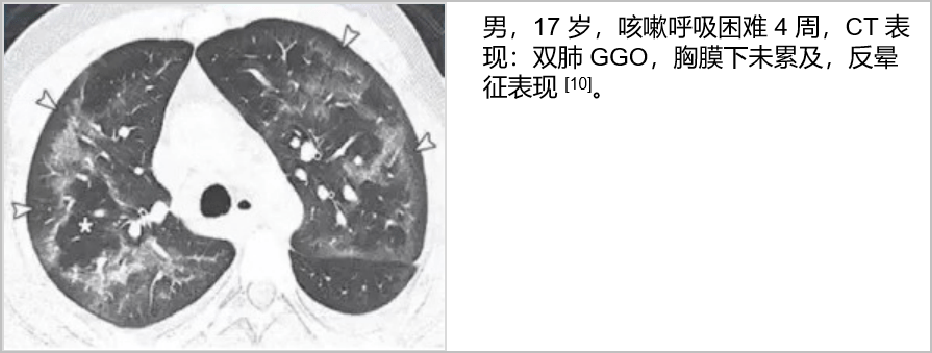 这些肺 ct 表现,竟都和「电子烟」有关?_肺部_治疗_诊断