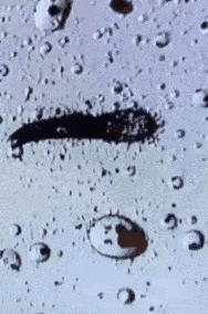 尸体头上抠下来的白泥竟是螨虫尸体!头痒头屑出油多,用它就对了