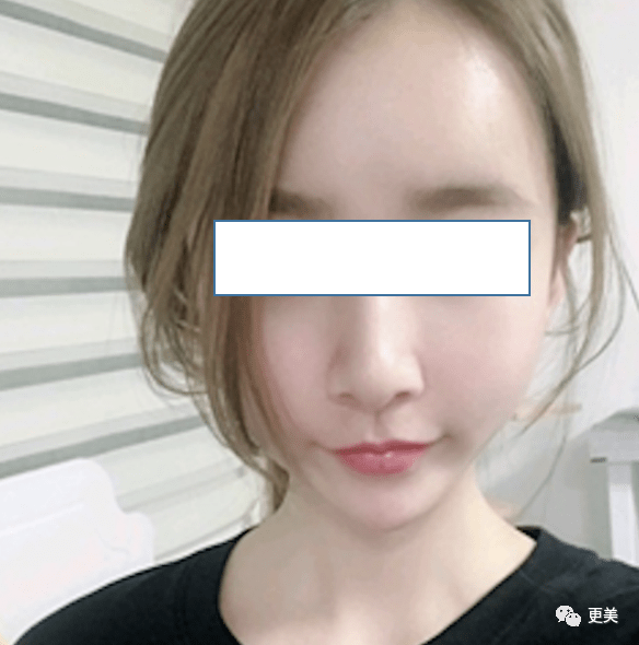 无辜为啥生娃5年的奶茶妹妹比热巴还嫩？