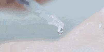 尸体头上抠下来的白泥竟是螨虫尸体!头痒头屑出油多,用它就对了