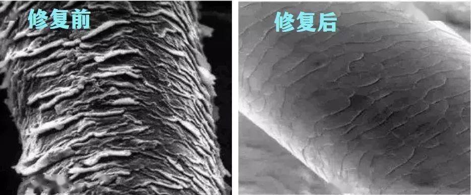 尸体头上抠下来的白泥竟是螨虫尸体!头痒头屑出油多,用它就对了