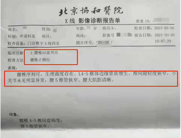 突然间,腰疼,去了北京协和医院拍了x光照片,检查结果是腰间盘突出