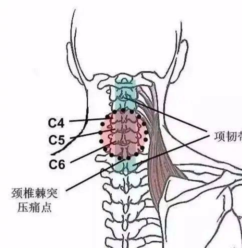 颈椎横突超声图像图片