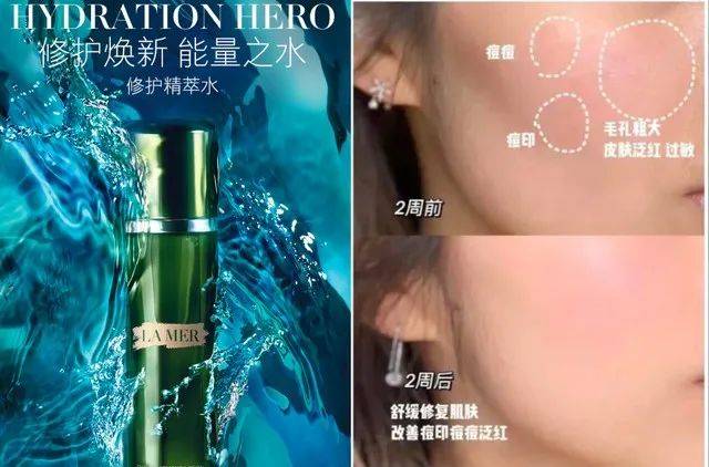 投资海蓝之谜正品5折价抢疯！补水、淡纹、修护，让你重回婴儿肌