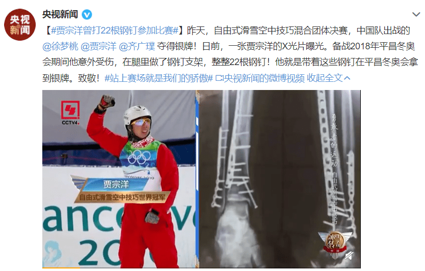 从图片上可以看出,贾宗洋曾经发生过小腿胫腓骨粉碎性骨折伴有内踝