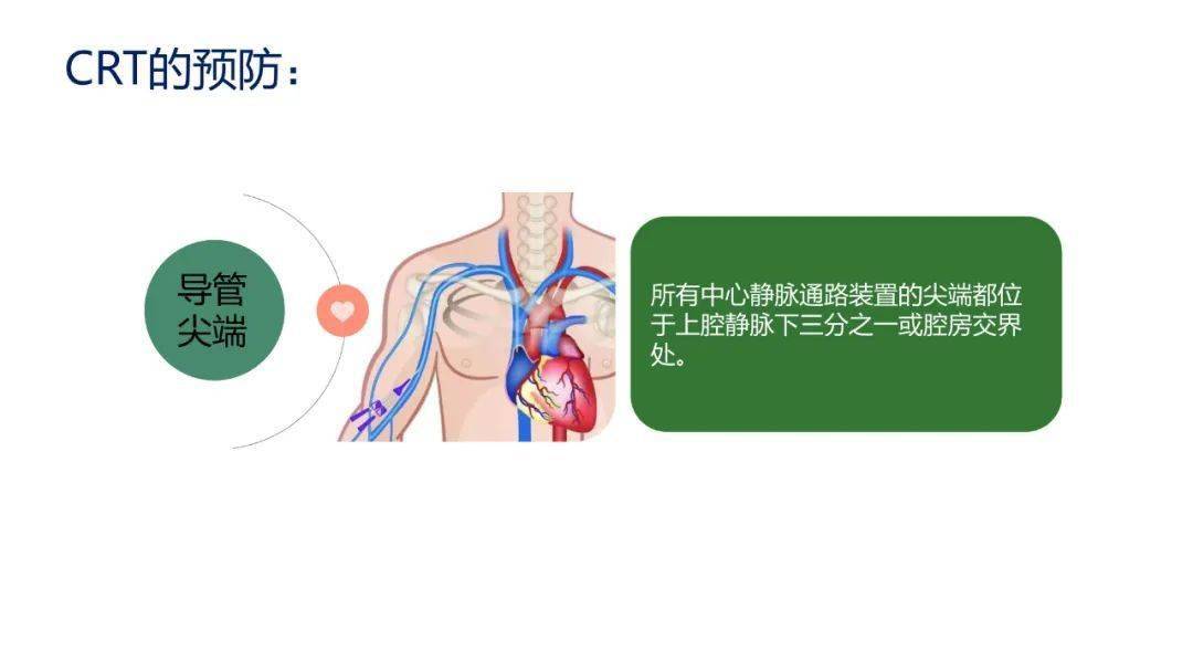 相关性|【周四讲堂】导管相关性静脉血栓的预防及处理