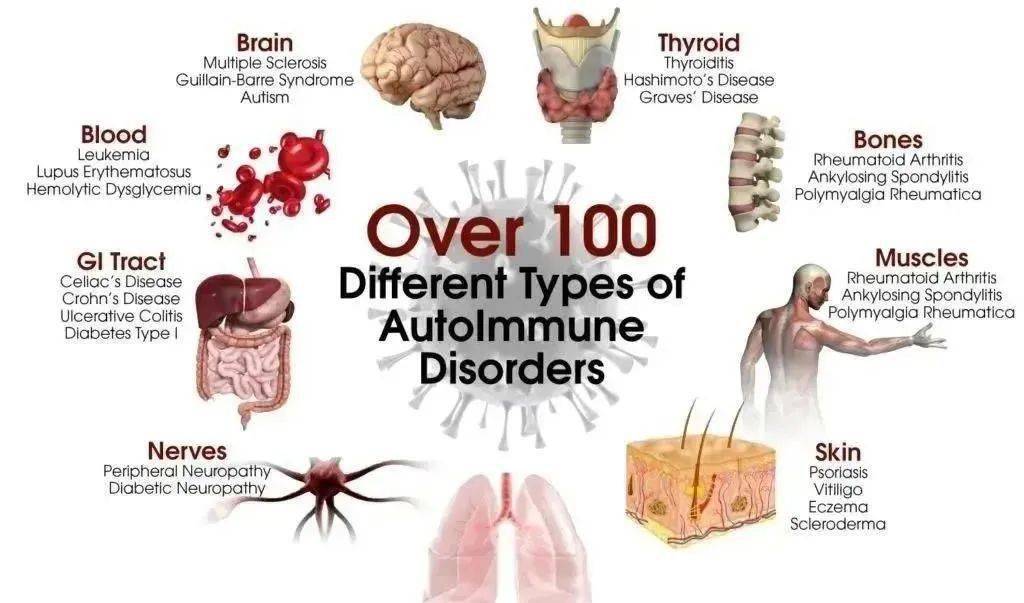 干细胞是自身免疫性疾病患者的希望